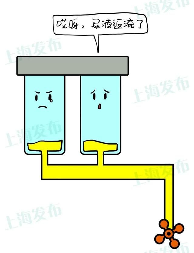 原尿藏在哪的简单介绍