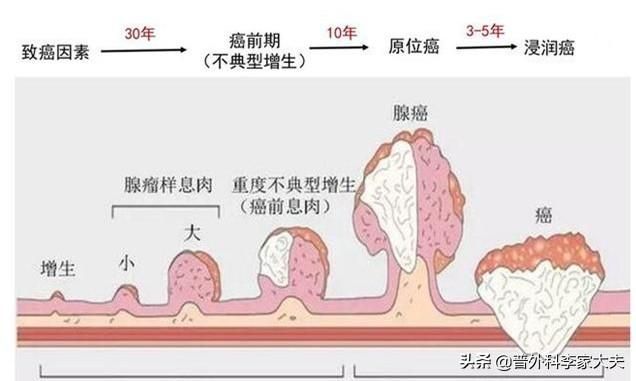 节肠在哪个部位(结肠在哪个部位图)