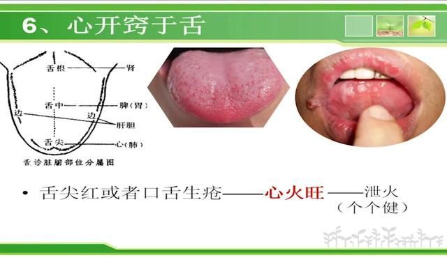 心前区在哪里(心前区在哪里)