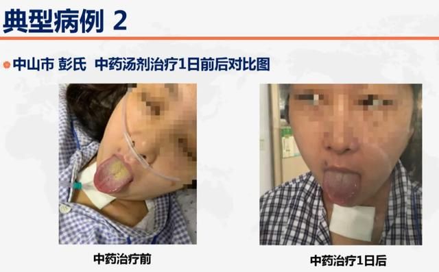 美国纽约在哪(美国纽约在哪个时区)