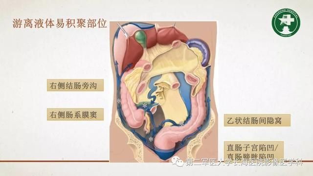 腹膜在哪里(附魔在哪里学)