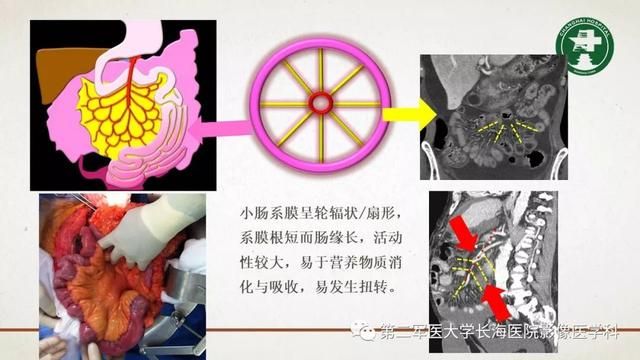 腹膜在哪里(附魔在哪里学)
