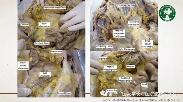腹膜在哪里(附魔在哪里学)