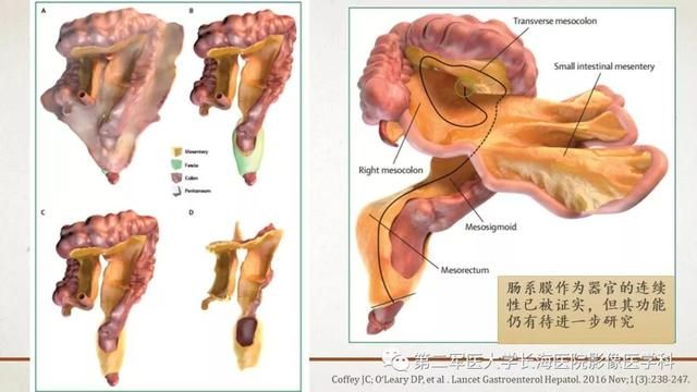 腹膜在哪里(附魔在哪里学)