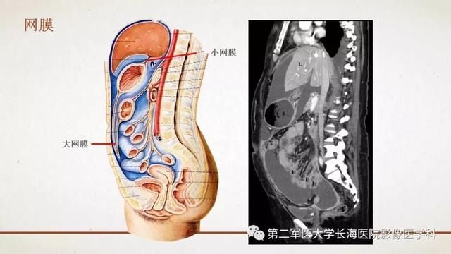 腹膜在哪里(附魔在哪里学)