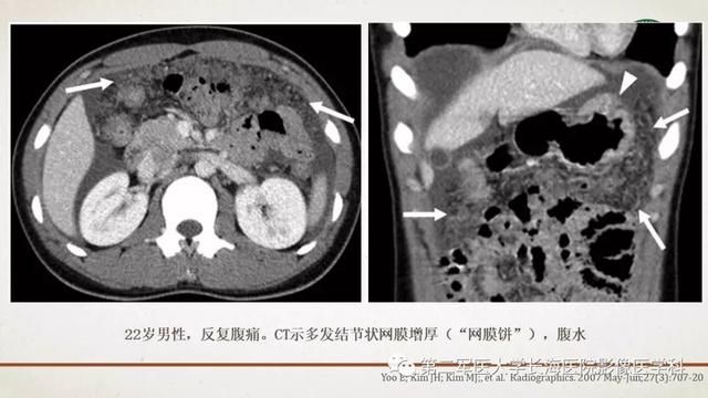 腹膜在哪里(附魔在哪里学)