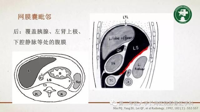 腹膜在哪里(附魔在哪里学)
