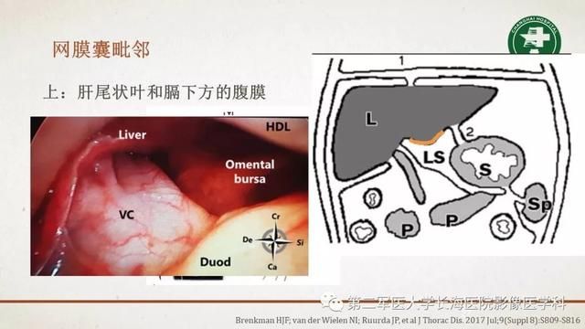 腹膜在哪里(附魔在哪里学)