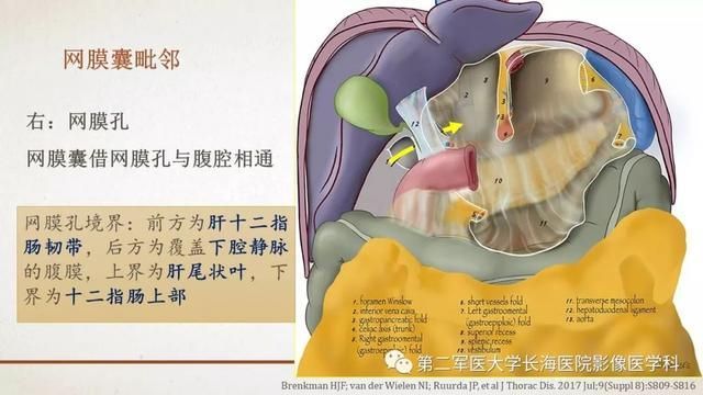 腹膜在哪里(附魔在哪里学)