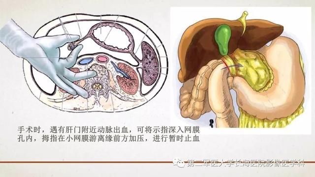腹膜在哪里(附魔在哪里学)