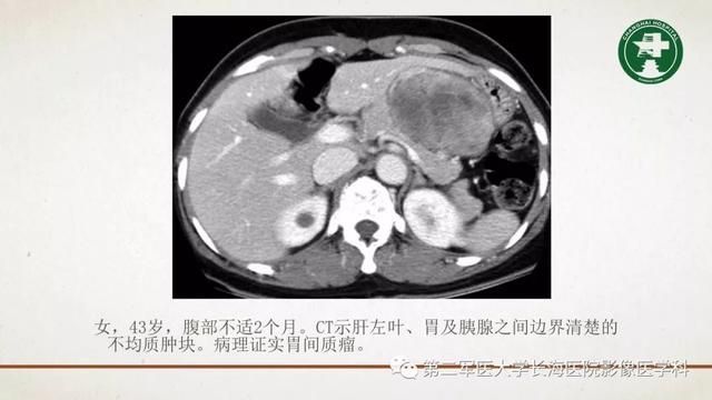 腹膜在哪里(附魔在哪里学)