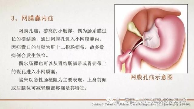 腹膜在哪里(附魔在哪里学)